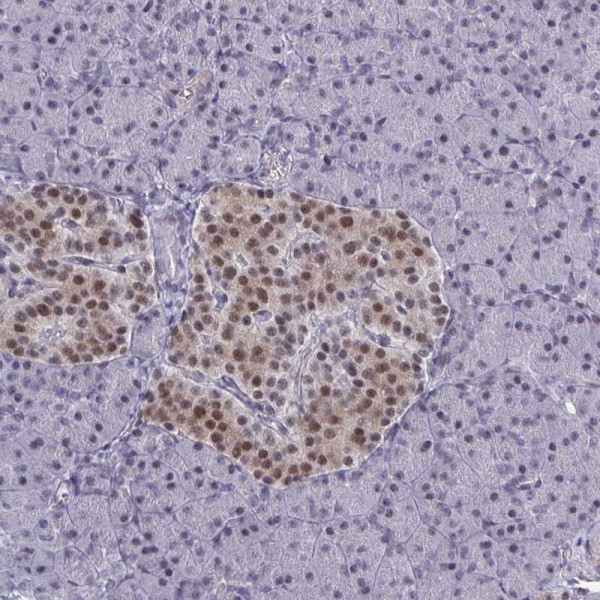 Anti-BCL7B