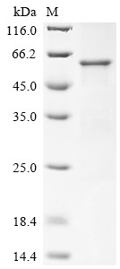 Myelin-associated glycoprotein (MAG), partial, human, recombinant