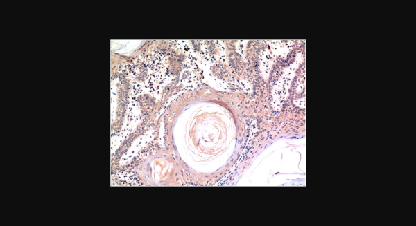 Anti-Caspase-3 (4B8), monoclonal
