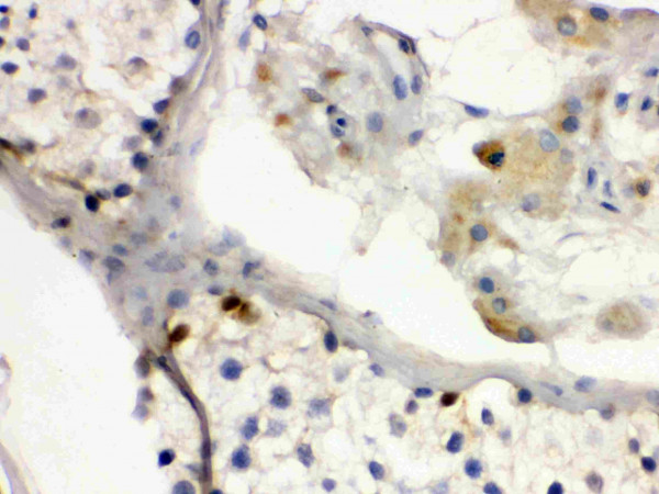Anti-DMRT1