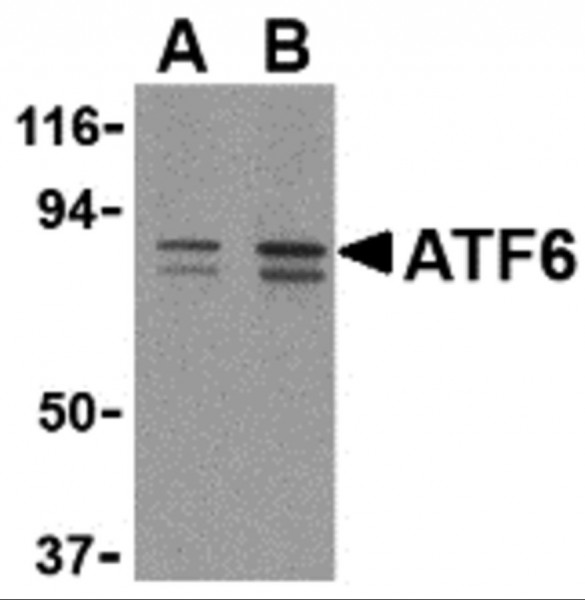Anti-ATF6