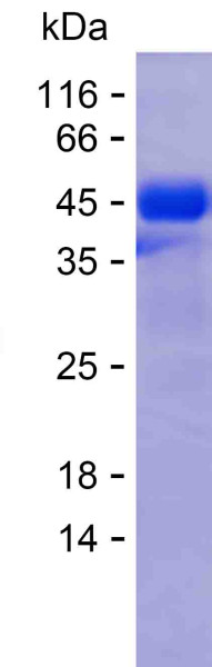KRT8 (human), recombinant protein
