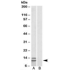Anti-P15 INK4b (isoform 2)