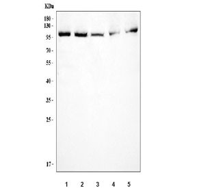 Anti-FER / Tyrosine-protein kinase Fer