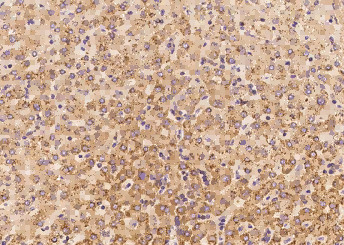 Anti-IL-6 Monoclonal Antibody