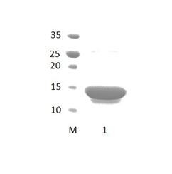 GRID2IP_2 PDZ Domain