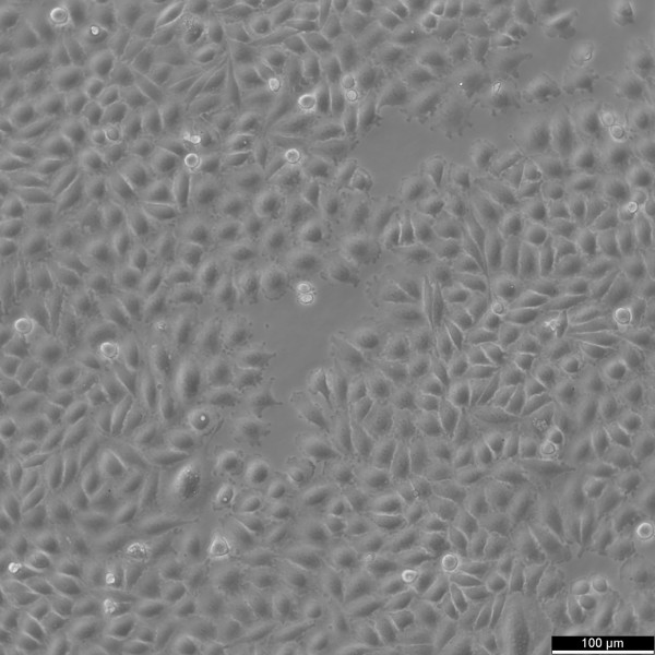SNU-668 Cells