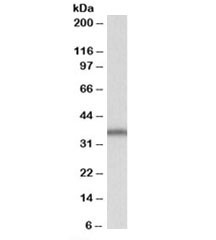 Anti-SLC9A3R2 (isoforms b &amp; e)