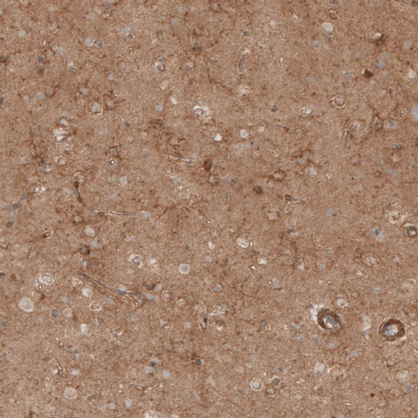 Anti-CSPG4