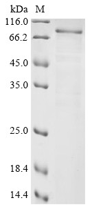Xylosyltransferase 2 (XYLT2), partial, human, recombinant