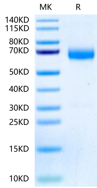 Human ANGPTL3/Angiopoietin-like 3 Protein