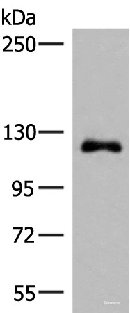 Anti-ARHGAP45