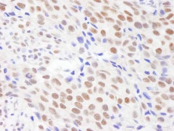 Anti-CPSF68 (IHC)