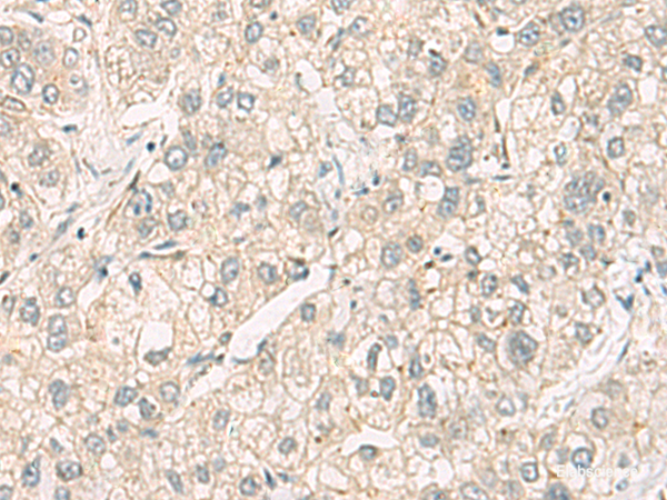 Anti-C3orf38