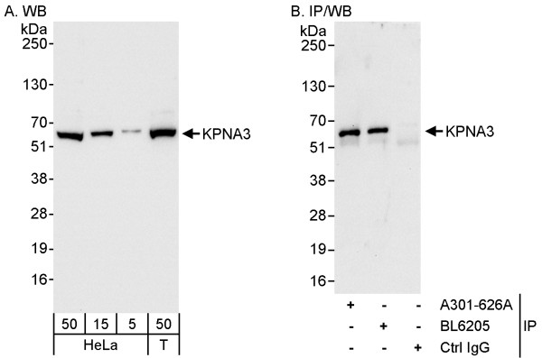 Anti-KPNA3