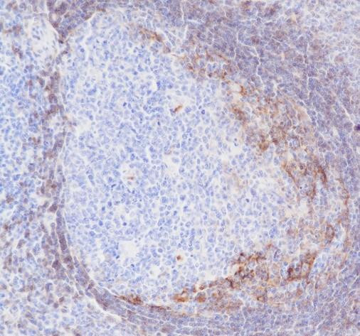 Anti-Recombinant CD23, clone A166