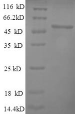 Hyaluronidase-1 (HYAL1), human, recombinant