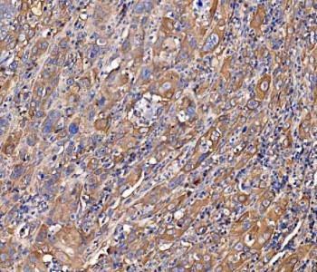 Anti-SCRN1 / Secernin-1