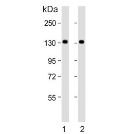 Anti-PFAS / Phosphoribosylformylglycinamidine synthase