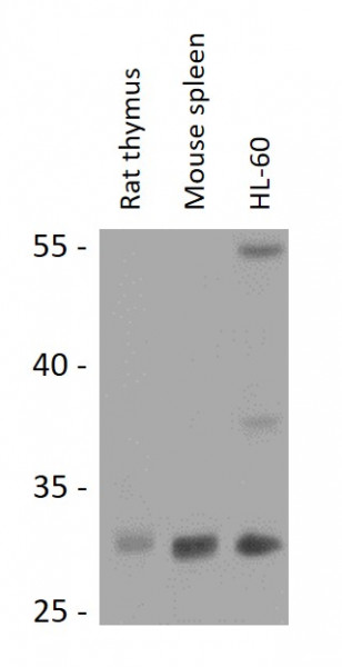 Anti-RPIA