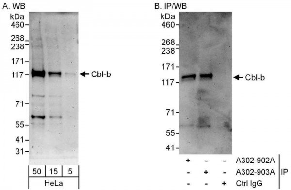 Anti-Cbl-b