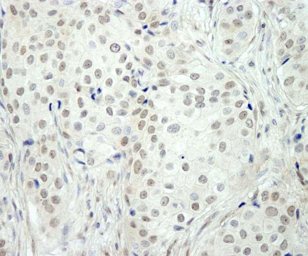 Anti-NCOA5/CIA IHC Antibody, affinity purifie (IHC)