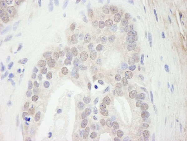 Anti-Menin (IHC)