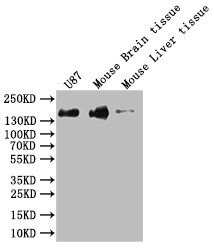 Anti-SF3B1 Recombinant Monoclonal, clone 6C7