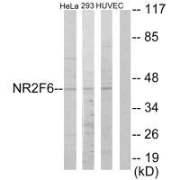 Anti-NR2F6