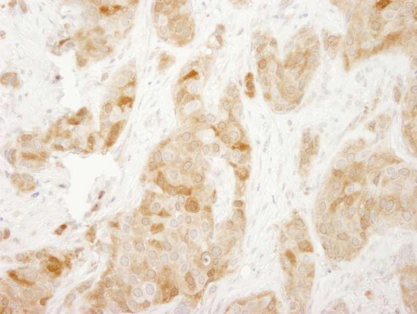 Anti-RPS6 (IHC)