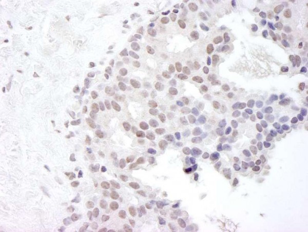 Anti-Gemin4 (IHC)