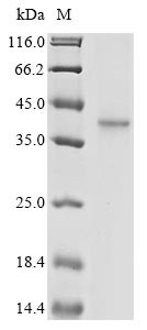 Spike glycoprotein (S), partial, human coronavirus OC43, recombinant