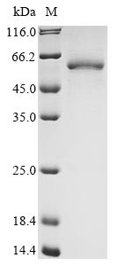 Leucine-rich repeat and immunoglobulin-like domain-containing nogo receptor-interacting protein 1 (L