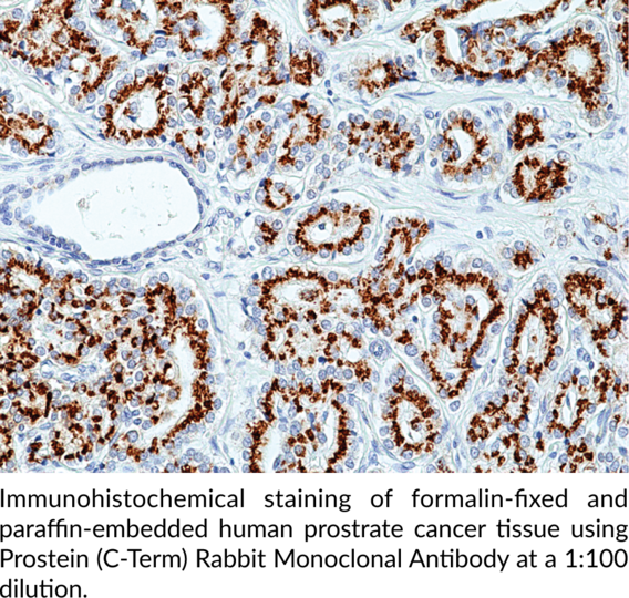 Anti-Prostein (C-Term) Rabbit Monoclonal Antibody (Clone RM426)