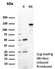 Anti-GCHFR / GFRP, clone GCHFR/7731