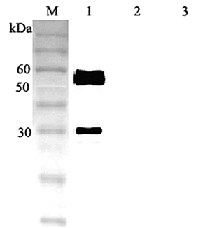 Anti-ANGPTL3 (human)