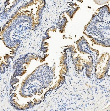 Anti-Ribonuclease Inhibitor / RNH1, clone 4F3