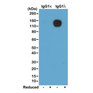 Anti-Ig Lambda Light Chain (mouse), Rabbit Monoclonal (RM110)