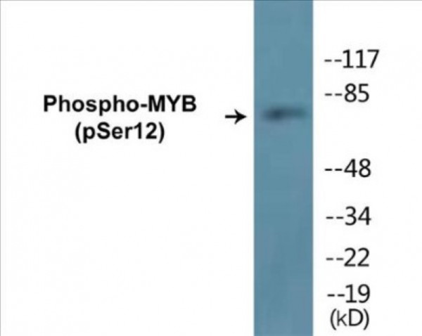 MYB (Phospho-Ser12) Colorimetric Cell-Based ELISA Kit