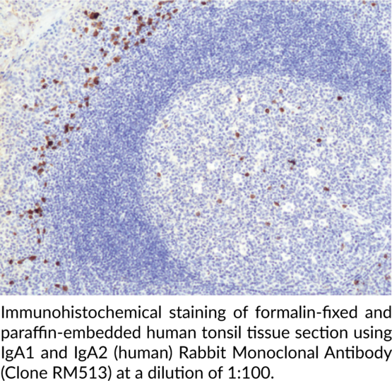 Anti-IgA1 and IgA2 (human) Rabbit (Clone RM51