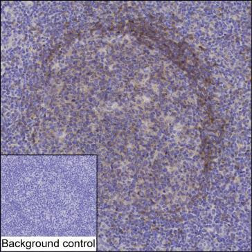 Anti-CD22