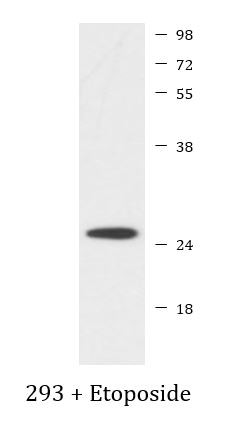 Anti-C Reactive Protein