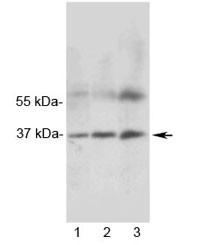 Anti-MRGX1