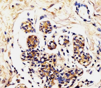 Anti-Alpha Lactalbumin / LALBA