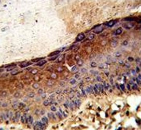 Anti-UDP-glucose 4-epimerase / GALE