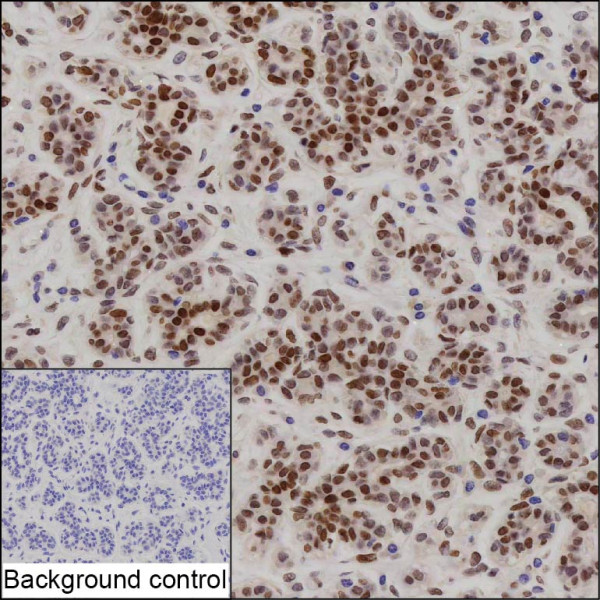 Anti-BRCA1 (recombinant antibody)