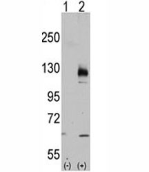 Anti-TRPM8