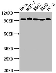 Anti-TOP1 Recombinant Monoclonal, clone 6D8