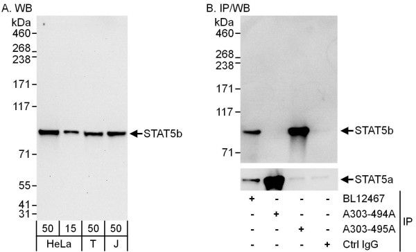 Anti-STAT5b