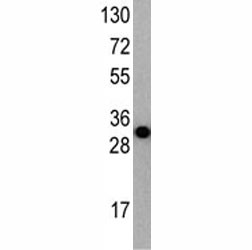 Anti-ATG7, clone 29CT10.3.12